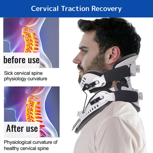 Adjustable Cervical Collar - Neck Brace Orthosis - Detail View | Alpha Medical Care