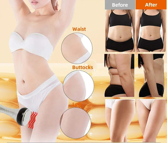 4-in-1 Cavitation Body Slimming Machine - 40K Ultrasound - Side View | Alpha Medical Care