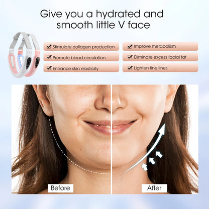 Face Lifting Device - Red Light Skin Rejuvenation & V-Face - Back View | Alpha Medical Care