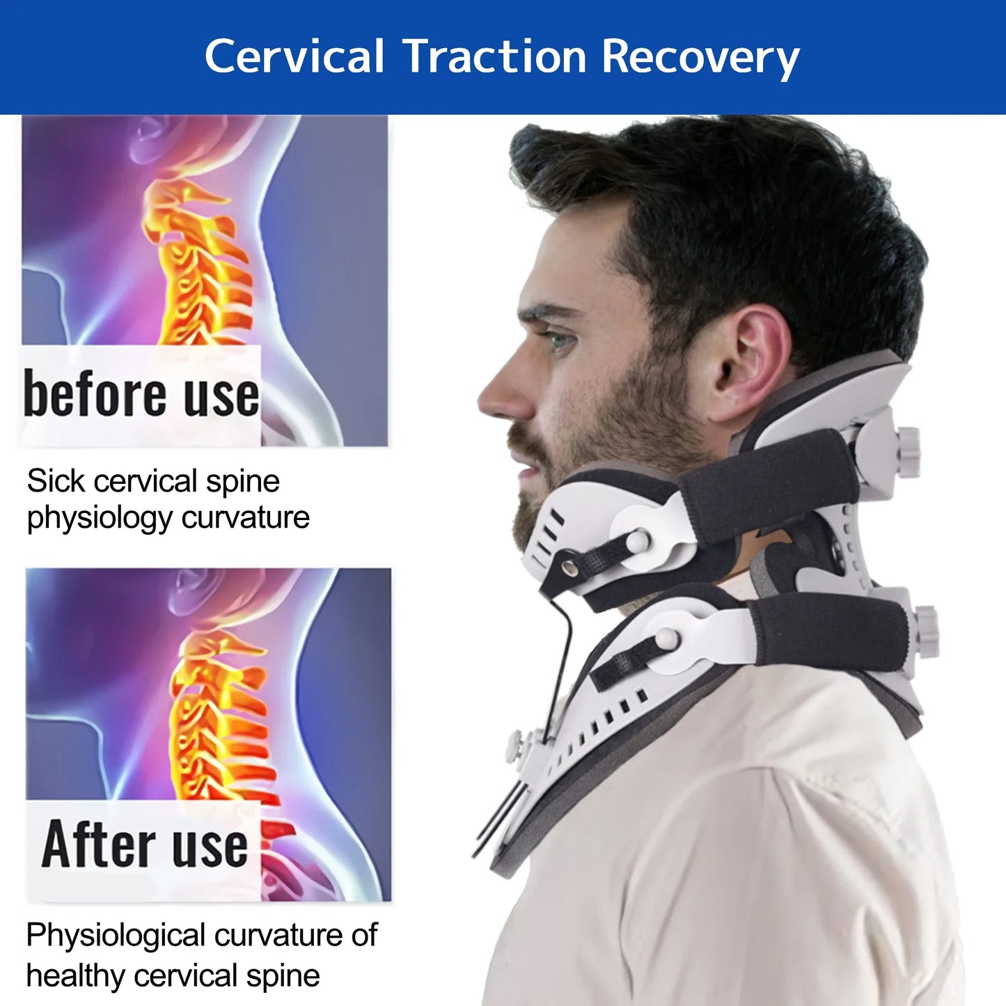 Adjustable Cervical Collar - Neck Brace Orthosis - Detail View | Alpha Medical Care