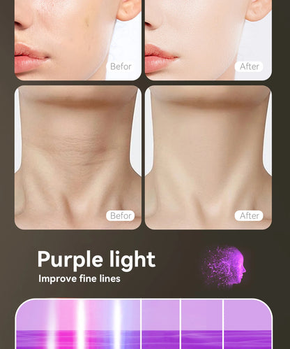 Hello Face Red Light Therapy Mask - Face & Neck Infrared LED - View 19 | Alpha Medical Care