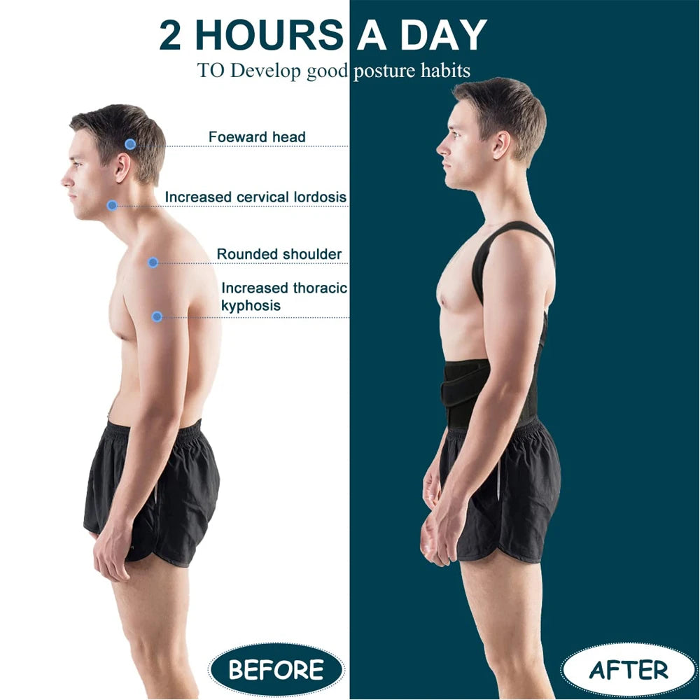 Back Brace Posture Corrector - Scoliosis & Hunchback Support - In Use | Alpha Medical Care