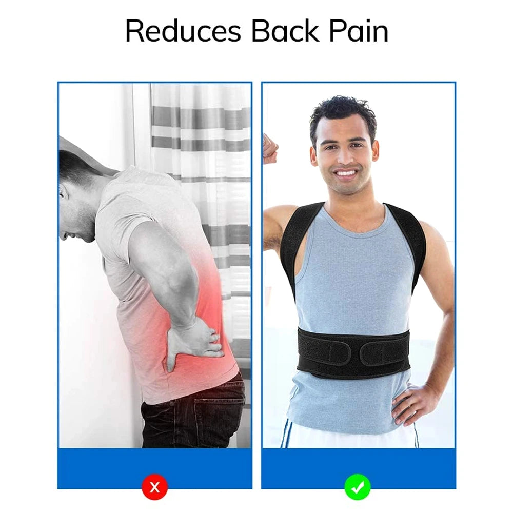 Back Brace Posture Corrector - Scoliosis & Hunchback Support - Side View | Alpha Medical Care
