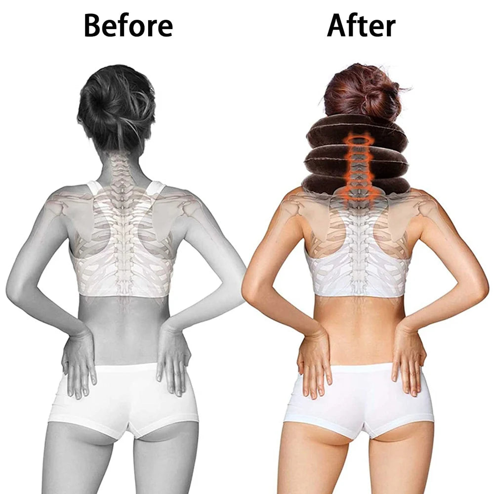 Cervical Neck Traction Device - Inflatable Home Relief - View 19 | Alpha Medical Care