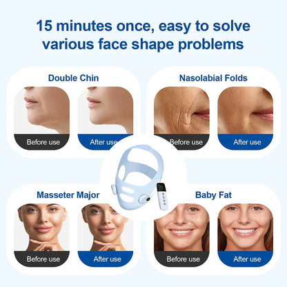 V-Line Face Slimming - EMS Lifting Microcurrent Device - Features | Alpha Medical Care