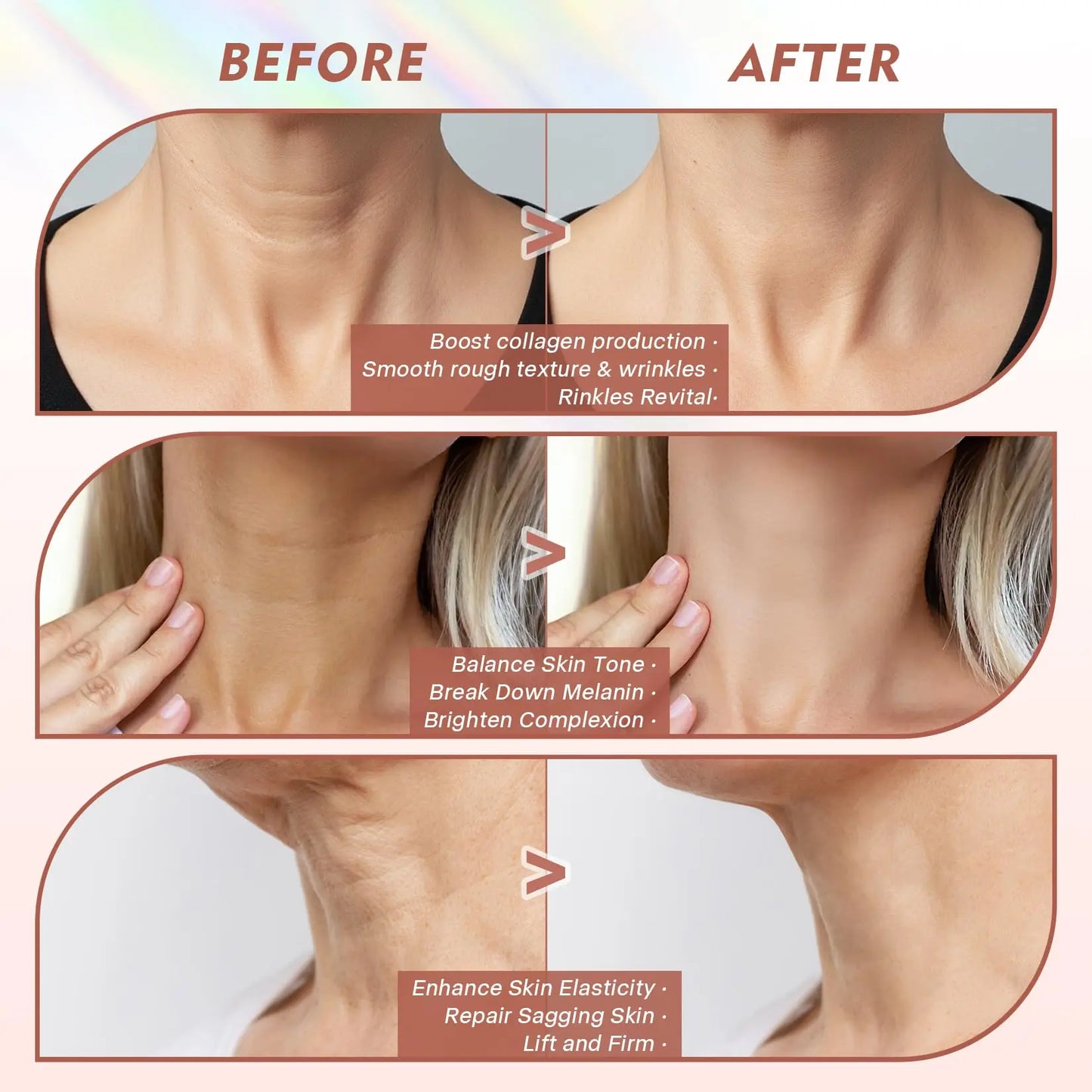 Neck LED Lift Mask - Anti-Wrinkle Skin Tightening - Side View | Alpha Medical Care