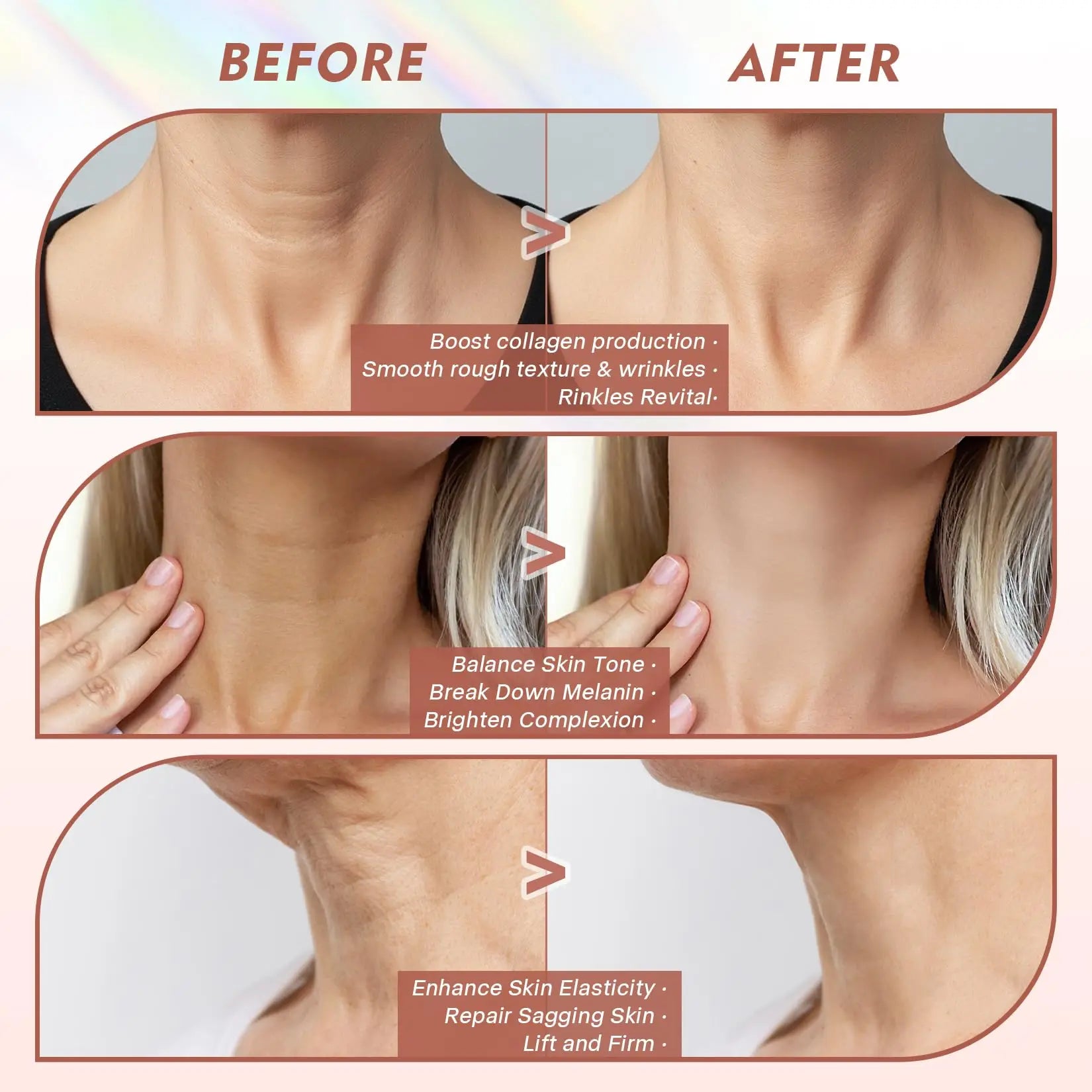 Neck LED Lift Mask - Anti-Wrinkle Skin Tightening - Side View | Alpha Medical Care