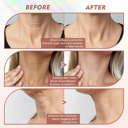 Neck LED Lift Mask - Anti-Wrinkle Skin Tightening - Side View | Alpha Medical Care