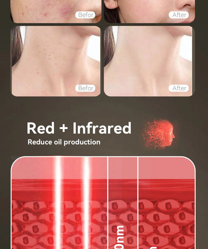 Hello Face Red Light Therapy Mask - Face & Neck Infrared LED - View 17 | Alpha Medical Care