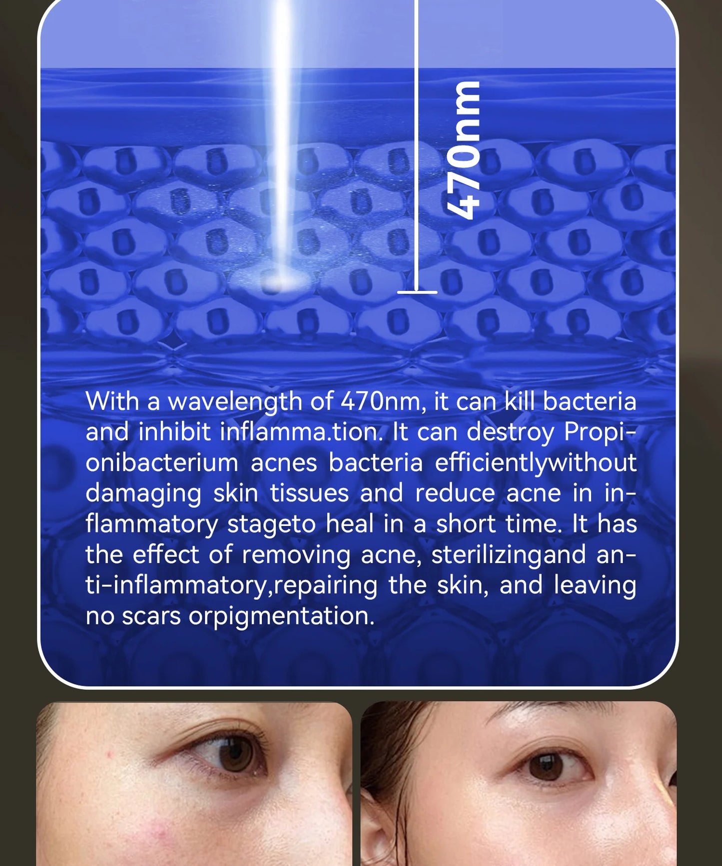 Hello Face Red Light Therapy Mask - Face & Neck Infrared LED - View 16 | Alpha Medical Care