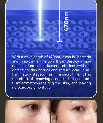 Hello Face Red Light Therapy Mask - Face & Neck Infrared LED - View 16 | Alpha Medical Care